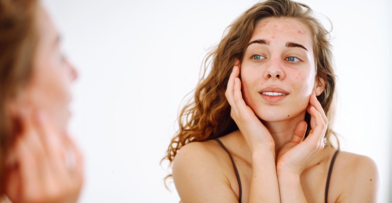 Pelle spenta in autunno? Cause e i rimedi Pelle spenta in autunno? Cause e i rimedi