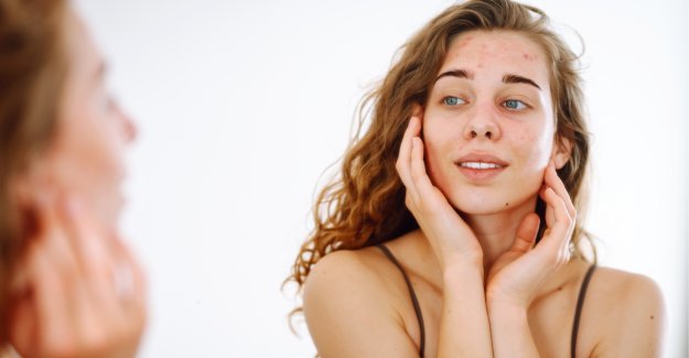 Pelle spenta in autunno? Cause e i rimedi