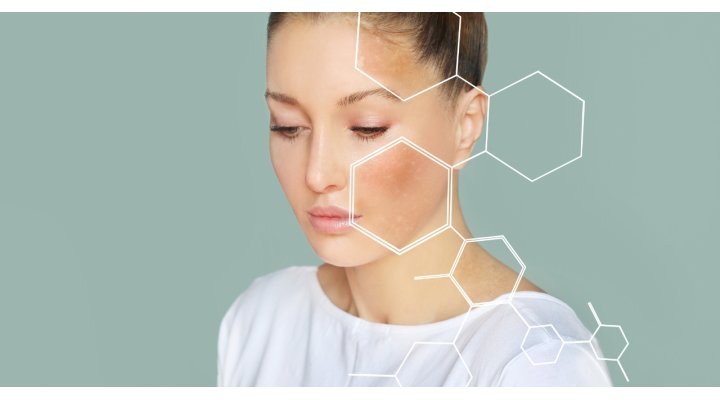 Pelle spenta dopo l’estate? Ecco come rinnovarla Pelle spenta dopo l’estate? Ecco come rinnovarla