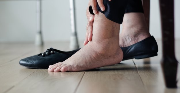 Piedi gonfi, cause e rimedi