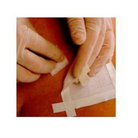 REMOVE 50 SALVIETTE ADES.CUTE