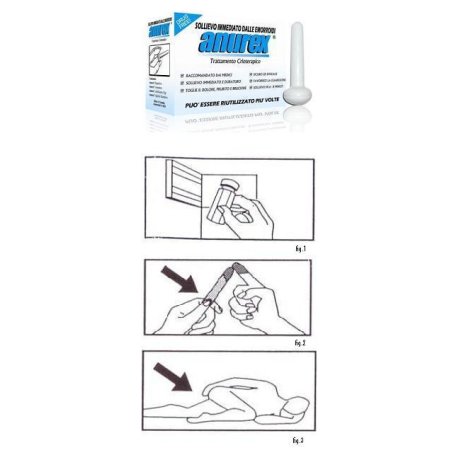 ANUREX CRIOTERAPIA EMORR ANUREX CRIOTERAPIA EMORR